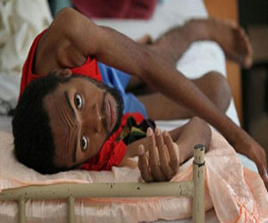   مصر اليوم - فرنسا تؤكد التزامها بمكافحة المرض في اليوم العالمي لمكافحة السل