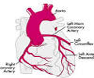   مصر اليوم - توسيع الشرايين من أنواع جراحات القلب