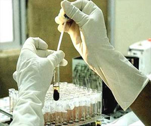   مصر اليوم - حَملة مَجانيّة للكشف عن فيروس سي في جَامِعة الأزهر