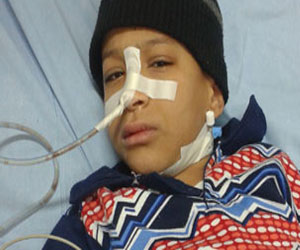   مصر اليوم - الإشتباه بأول إصابة بشلل الأطفال منذ 14 عامًا في العراق