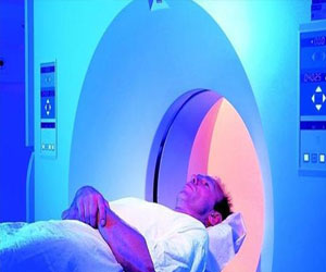   مصر اليوم - الرنين المغناطيسي لتشخيص سرطان البروستاتا بدقة دون ألم