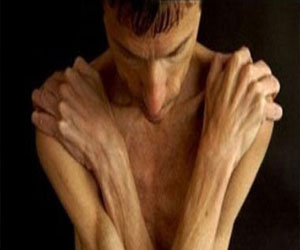   مصر اليوم - النحفاء أكثر عرضة الي الموت من البدناء