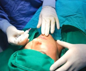   مصر اليوم - إجراء عمليات جراحية في الجزائر لمعانون على مستوى الشفة