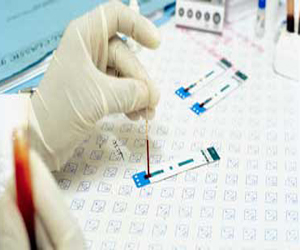   مصر اليوم - مسئول إثيوبي يعلن انخفاض معدل الإصابة بمرض الإيدز