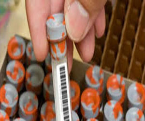   مصر اليوم - الصحة المغربية: لا إصابات بفيروس إيبولا في البلاد