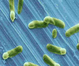   مصر اليوم - اكتشاف مادة من السيليسيوم الأسود قادرة علي قتل البكتريا