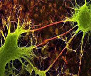   مصر اليوم - اكتشاف البروتين المسئول عن نمو الألياف العصبية التالفة