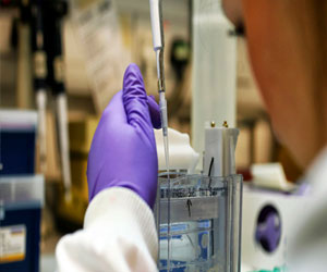   مصر اليوم - اكتشاف طريقة فعالة لإضعاف خلايا السرطان