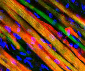   مصر اليوم - إنماء عضلة هيكلية قادرة على الشفاء الذاتي