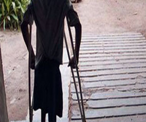   مصر اليوم - جراحة لزرع جهاز كهربائي في الحبل الشوكي لعلاج مرضي الشلل