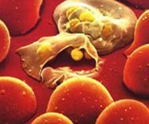   مصر اليوم - أنيميا الفول تقتل طفلين وتصيب 50 آخرين جنوبى اليمن