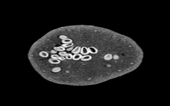   مصر اليوم - الرنين المغناطيسيّ يكشف عن حركات كالانفجار الكونيّ داخل الفواكه والخضروات