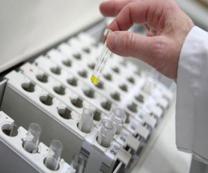   مصر اليوم - إنشاء مخبر ذي تأمين عال للفيروسات الناشئة في الجزائر