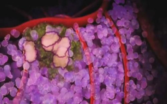   مصر اليوم - افتتاح أول بنك حيوي للأنسجة السرطانيَّة في الأردن بدعم من الاتحاد الأوروبي