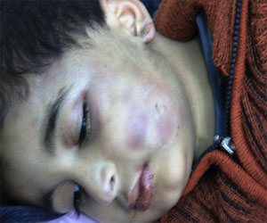   مصر اليوم - رصد حالات إنتهاكات ضد الأطفال في المؤسسة التعليمية