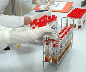   مصر اليوم - باحث سعودي ينجح في إنتاج أحدث الكواشف والمحاليل المخبرية بالمملكة