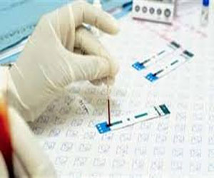   مصر اليوم - الاختبار الذاتي سلاح جديد للكشف عن فيروس الإيدز