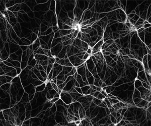   مصر اليوم - فريق علماء مصري يكتشف الجين المسبب لضمور الخلايا العصبية