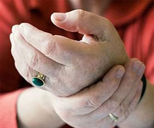   مصر اليوم - فحص جديد متطور للكشف المبكر عن إلتهاب المفاصل قبل بدء الأعراض