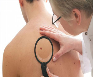   مصر اليوم - نصائح طبية لتجنب سرطان الجلد