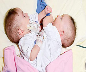   مصر اليوم - السفير العراقي يزور التوأم كريس وكرستيان للاطمئنان على صحتهما