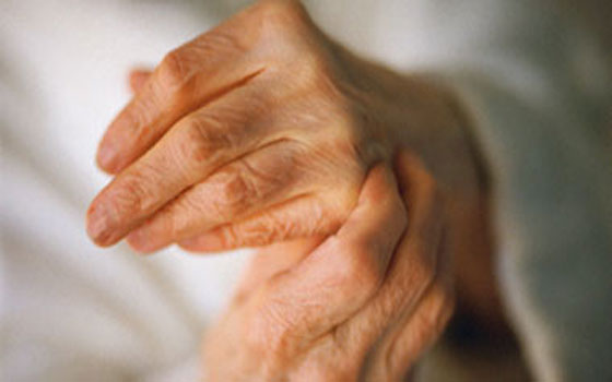   مصر اليوم - الاتحاد النسائي العام يعرض أسباب مرض التهاب المفاصل وأعراضه وعلاجه