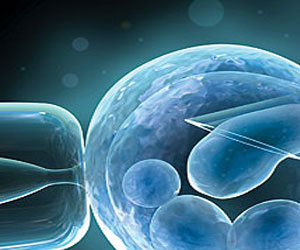   مصر اليوم - علماء يتوصلون إلى بروتين قد يساعد في علاج العقم