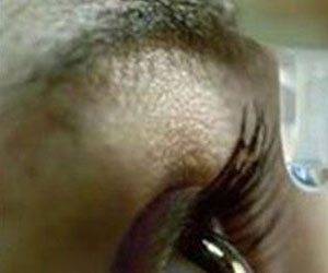 مصر اليوم - القطرة الخالية من المواد الحافظة أنسب لعلاج العين