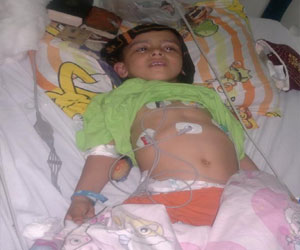 مصر اليوم - طفل يفقد بصره بعد استئصال اللوز في الغردقة