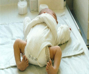   مصر اليوم - ألف مولود فرنسي لديهم عيب خلقي وراثي في 2011