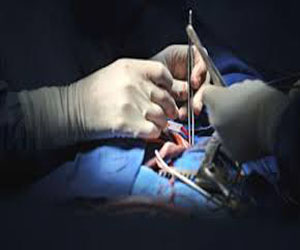   مصر اليوم - نجاح زراعة رحم ومهبل صناعي لأول مرة لأربع فتيات