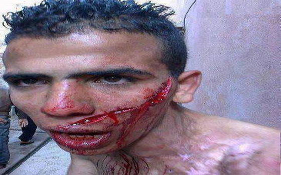   مصر اليوم - التشرميل تثيرُ الرّعب في نفوس روّاد فيسبوك