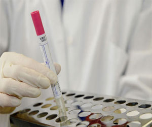   مصر اليوم - الأردن يعلن عن تسجيل إصابة كورونا لمريض سعودي