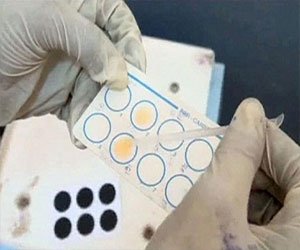   مصر اليوم - إيبولا يقتل 124 شخصًا في غينيا وليبيريا ونسبة النجاة 10%