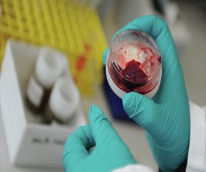   مصر اليوم - السعودية : 11 اصابة جديدة بفيروس كورونا