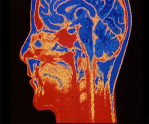   مصر اليوم - زراعة أجزاء إلكترونية في الدماغ البشري لمضاعفة قدراته