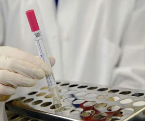   مصر اليوم - ماليزيا تجري فحوصات للـكورونا على الآتين من الشرق الأوسط