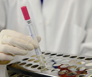   مصر اليوم - المغرب يؤكد عدم تسجيل أية إصابة بفيروس كورونا