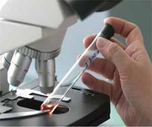   مصر اليوم - علماء روس يكتشفون فيروسًا يقضي على السرطان