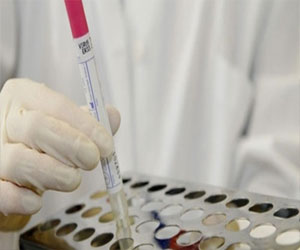   مصر اليوم - إرتفاع عدد الوفيات بـكورونا في السعودية إلى 94 شخصًا