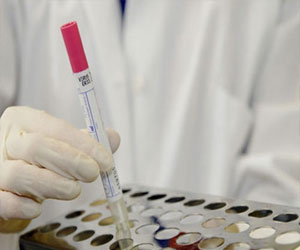   مصر اليوم - مستشفى قوى الأمن يشخص الكورونا في الرياض