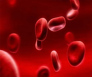   مصر اليوم - مراهق يجمع نحو 3 ملايين استرليني تبرعات لمرضى السرطان