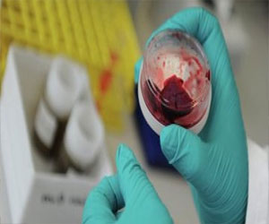   مصر اليوم - رفع حالة الطوارىء في القليوبية لمواجهة فيروس كورونا