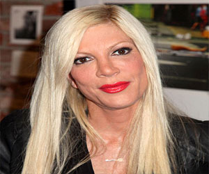   مصر اليوم - توري سبيلينغ في المستشفى بسبب الصّداع والقرحة