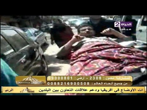 مساعد وزير الصحة يرد على فيديو كارثي