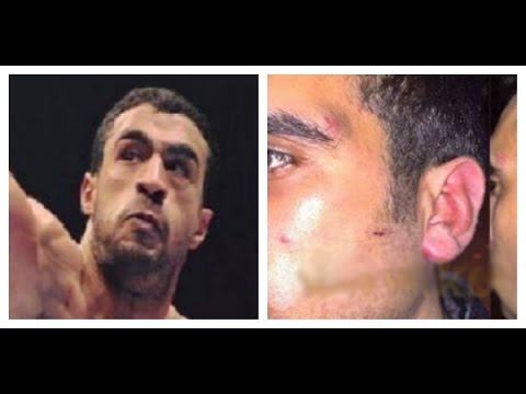 شاهد بدر هاري يعتدي على شاب في ملهى ليلي بسبب ”الفودكا”