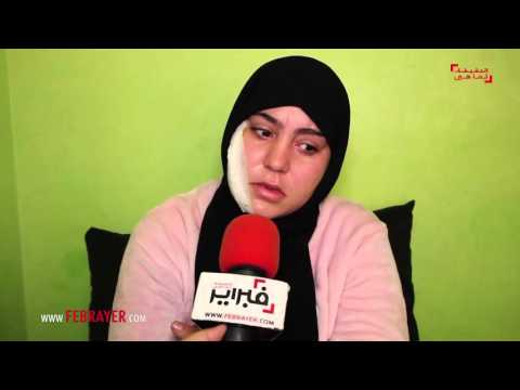 بالفيديو أوضحت أن زوجها أيقظها وضربها بطرانش فيه ثومة