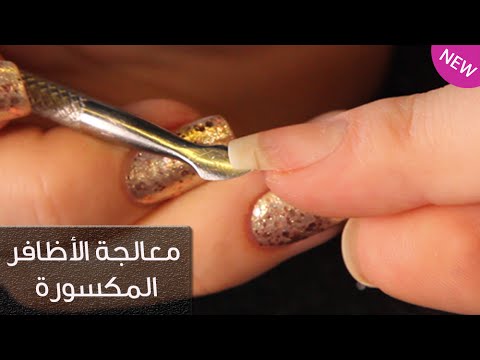 كيفية معالجة اظافر اليد المكسورة