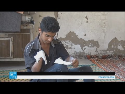طفل يروي تفاصيل قطع تنظيم داعش ليده