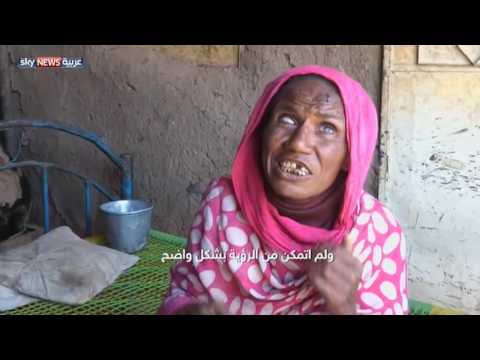 عائلة سودانية تصارع بؤس الفقر والأمراض دون أدنى الاحتياجات